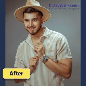 جراحی بینی - https://drtayebehkazemi.com/