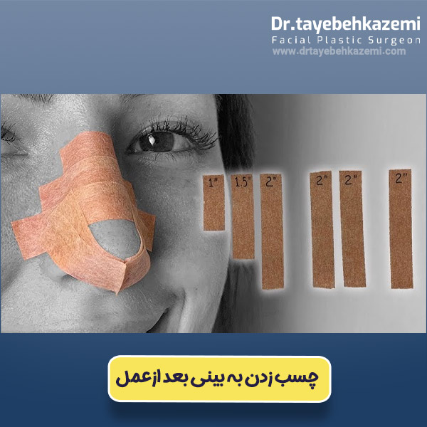 چسب زدن به بینی بعد از عمل - https://drtayebehkazemi.com/