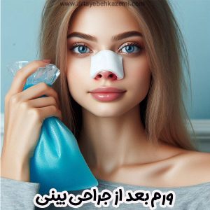 ورم بعد از جراحی بینی - https://drtayebehkazemi.com/
