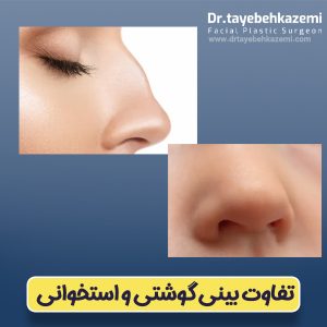 تفاوت بینی گوشتی و استخوانی - https://drtayebehkazemi.com/