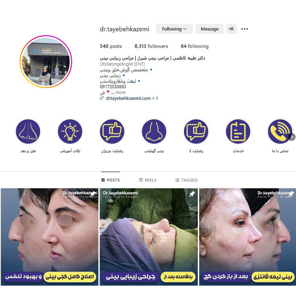 اینستاگرام بهترین جراح بینی شیراز - https://drtayebehkazemi.com/