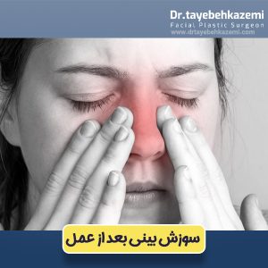 سوزش بینی بعد از عمل - https://drtayebehkazemi.com/