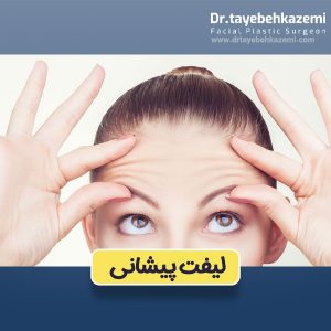 لیفت پیشانی