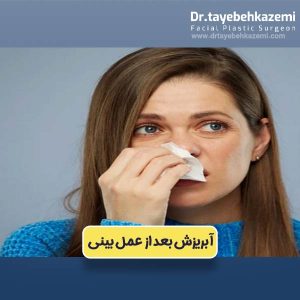 آبریزش بعد از عمل بینی