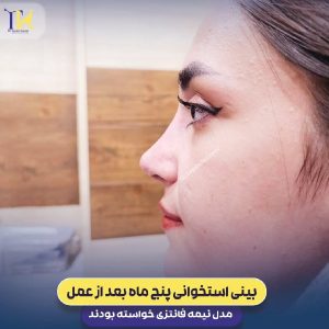 نمونه کار جراح بینی خوب در شیراز