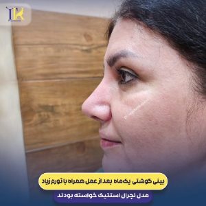 عکس نمونه کار دکتر بینی