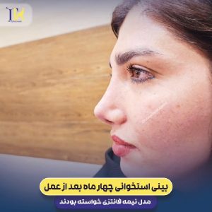 عکس نمونه کار جراح بینی در شیراز