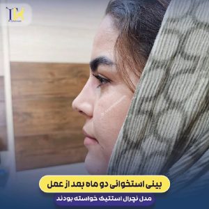 عکس نمونه کار بهترین جراح بینی شیراز