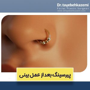 پیرسینگ بعد از عمل بینی