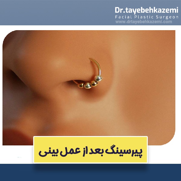 پیرسینگ بعد از عمل بینی 
